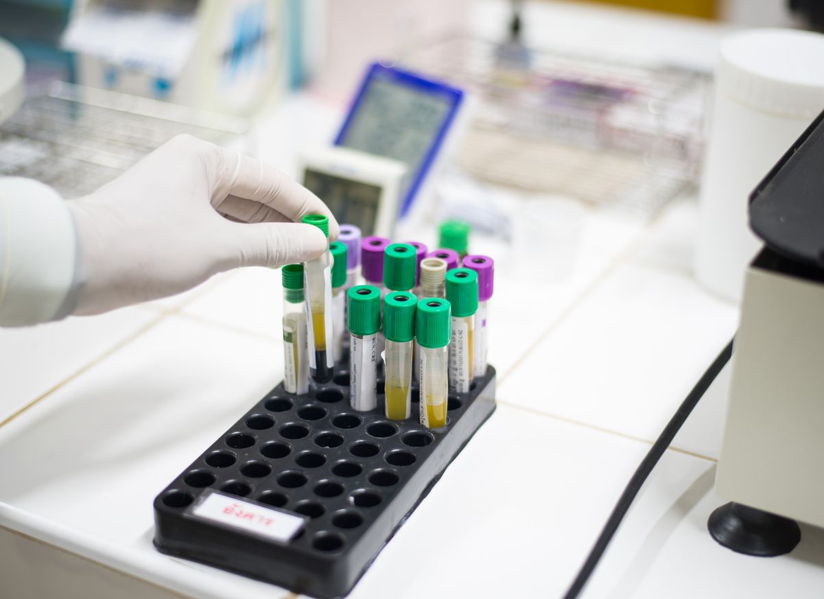 Tray of lab tubes with green and purple tops